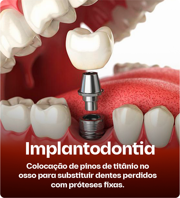 IMAGEM 7a